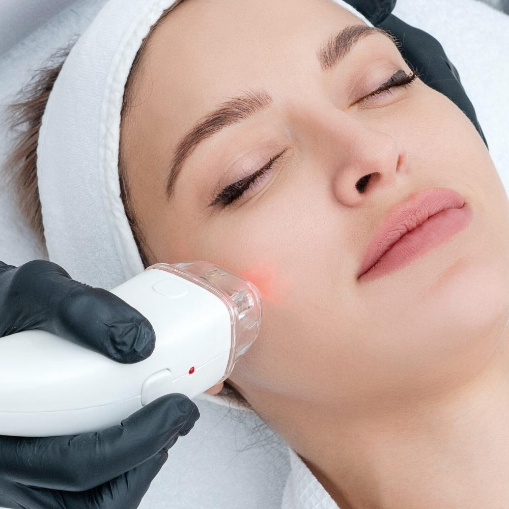 drplastic-upiresia-therapeies-dermatos-fractional-laser-home-001